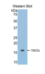 INHBB / Inhibin Beta B Antibody (aa297-411)