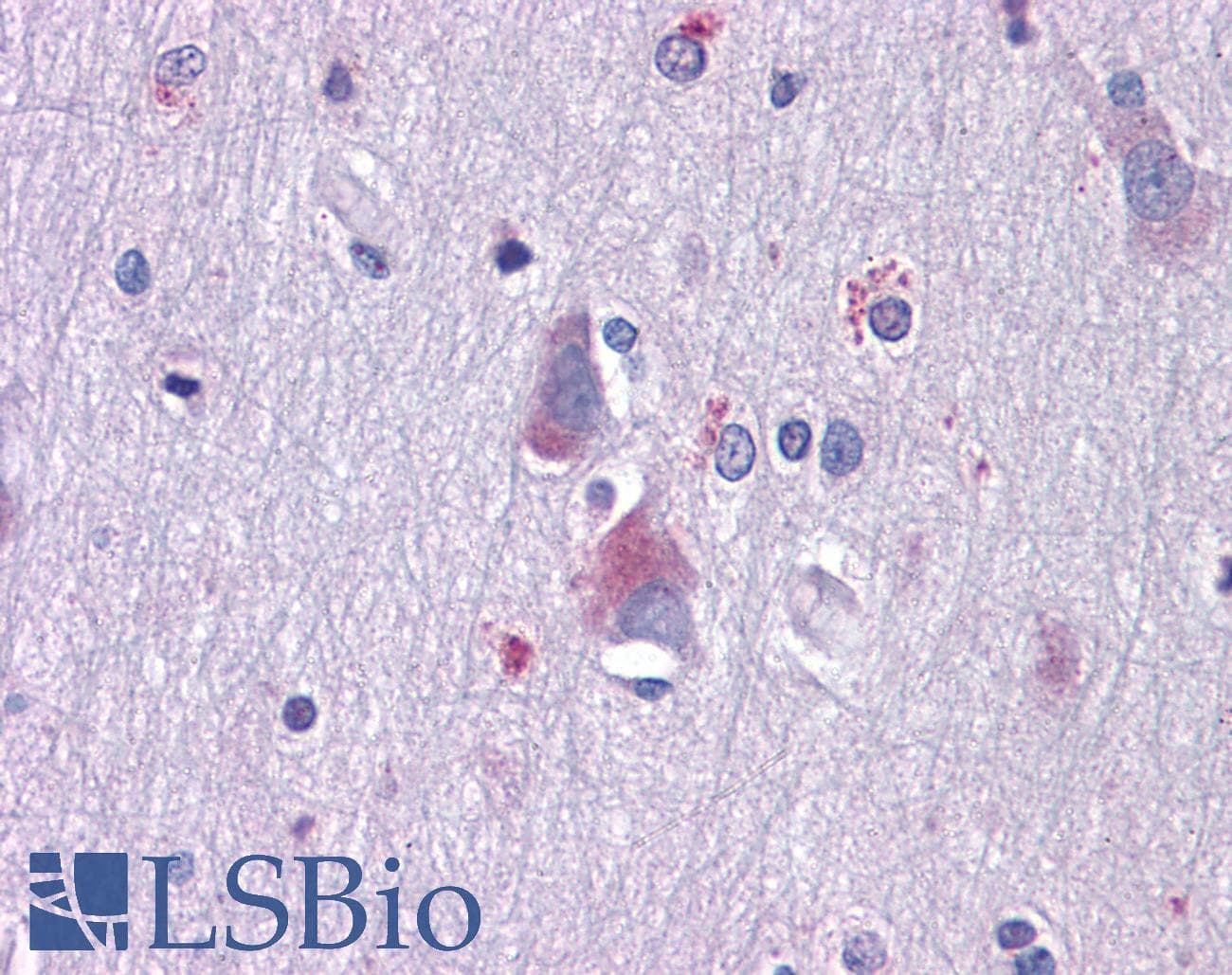 IHC-plus™ AXL Antibody (clone 7E10)