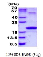 Human NTS / NT / Neurotensin Protein (Recombinant His)