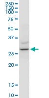 YWHAZ / 14-3-3 Zeta Antibody (clone 1B3)