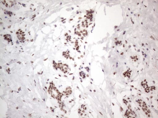 NR2C2 / TAK1 Antibody (aa1-241, clone OTI4B1)