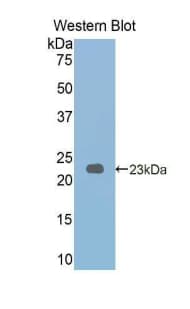 PYGL Antibody (aa341-509)