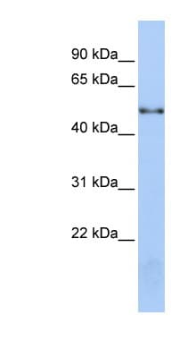 NOVA1 Antibody (aa395-444)