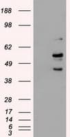 Monoclonal Mouse anti-Human STK3 Antibody (clone OTI2D4, IHC, WB)