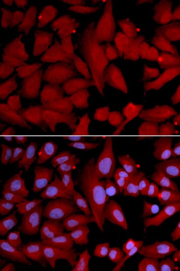 Polyclonal Rabbit anti-Human PSMA4 Antibody (IHC, IF, WB)