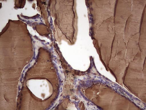 Monoclonal Mouse anti-Human TG / Thyroglobulin Antibody (clone OTI8C1, aa20-358, IHC)