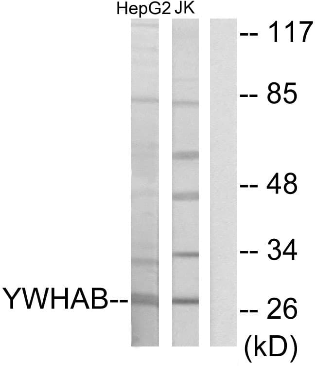 YWHAB / 14-3-3 Beta Antibody (aa41-90)