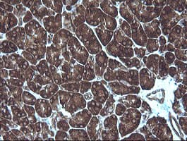 MAP2K1 / MKK1 / MEK1 Antibody (clone OTI2D2)