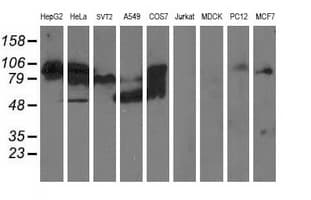 ALDH3A2 Antibody (clone OTI1H10)