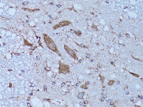 HADH Antibody