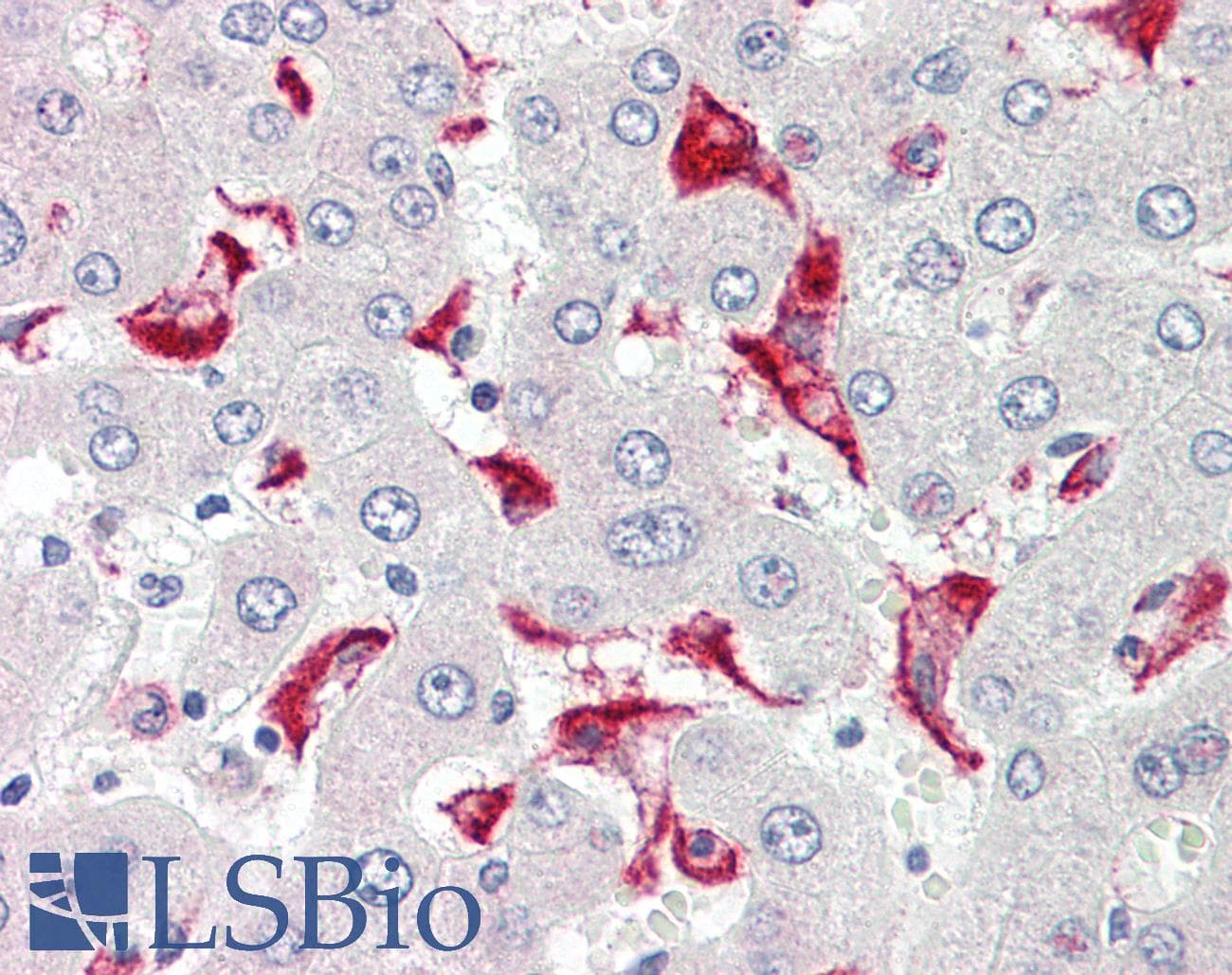 IHC-plus™ ATP5G2 Antibody (aa1-50)