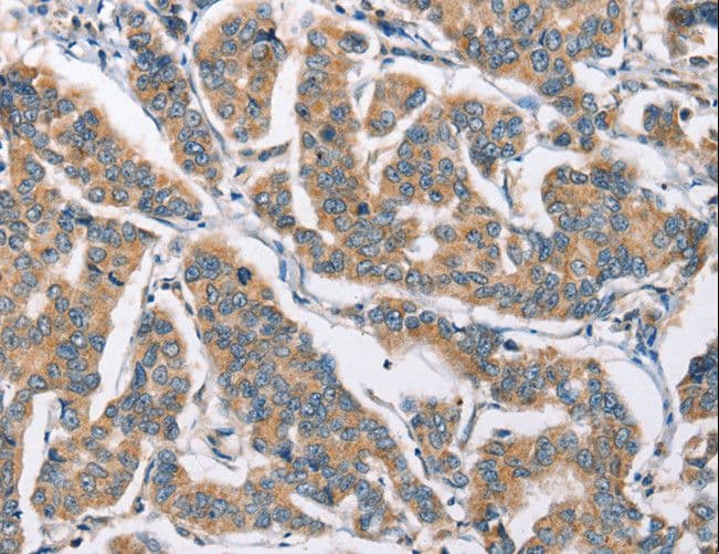 CAMK4 / CaMK IV Antibody