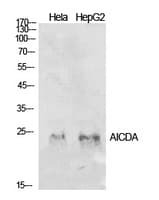 Polyclonal Rabbit anti-Human AICDA / AID Antibody (WB)