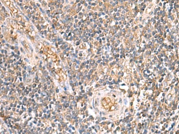 Polyclonal Rabbit anti-Human ARF5 Antibody (IHC)