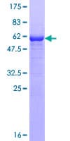 Human IPP2 / PPP1R2 Protein (Recombinant GST)