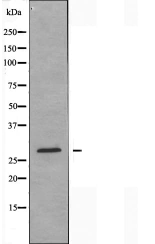 CLIC3 Antibody