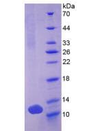 Human DEFB103A / BD-3 Protein (Recombinant His, N-Terminal)