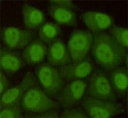 Monoclonal Mouse anti-Human RAD23B / HR23B Antibody (IHC, WB)