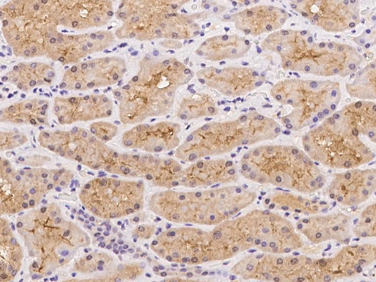 UNC13C Antibody