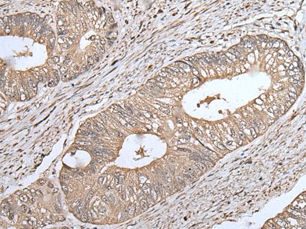 UQCRQ Antibody
