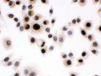 DAXX Antibody