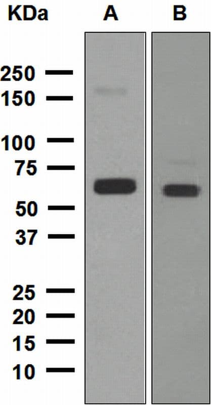 IHC-plus™ ALDH2 Antibody (Internal, clone EPR4493)