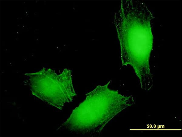 Monoclonal Mouse anti-Human MAGEA4 Antibody (clone 3D12, IF, WB)