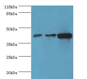PME-1 / PPME1 Antibody (Biotin)