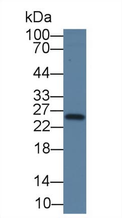 TK1 / TK / Thymidine Kinase Antibody (PE)
