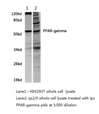 Polyclonal Rabbit anti-Human PPARG / PPAR Gamma Antibody (WB)