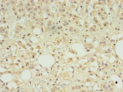 NDSP / FAM163A Antibody
