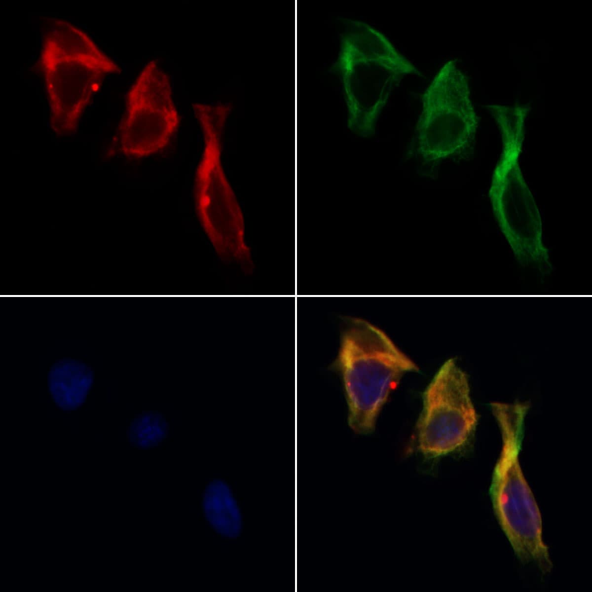 WNT2B Antibody