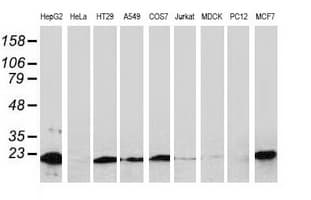 NDUFB9 Antibody (clone OTI3E11)