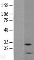 C10orf111 Protein (Over-Expression Lysate Myc-DDK (Flag))