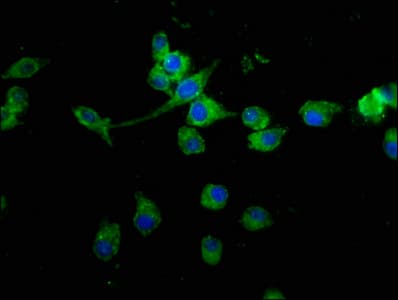 MED15 / ARC105 Antibody