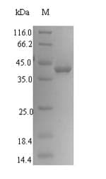 Human SLC1A6 / EAAT4 Protein (Recombinant GST, N-terminus)