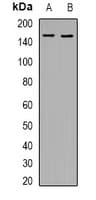 KDM4A / JHDM3A / JMJD2A Antibody