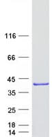 Human HMGCLL1 Protein (Recombinant Myc-DDK (Flag))