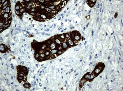 Monoclonal Mouse anti-Human KRT19 / CK19 / Cytokeratin 19 Antibody (clone UMAB2, Carrier-free, aa240-390, IHC, IF, WB)