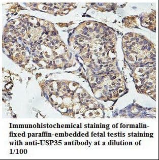 Polyclonal Rabbit anti-Human USP35 Antibody (aa56-264, IHC, WB)