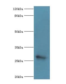 MED6 Antibody (aa27-246)