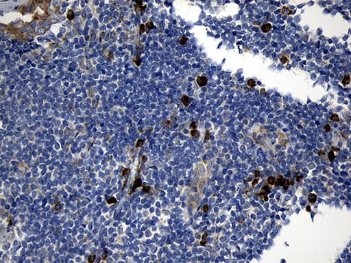 CCDC22 Antibody (clone OTI2E4)
