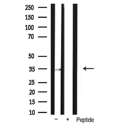 CCND1 / Cyclin D1 Antibody (phospho-Ser90)