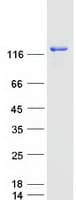 Human USP25 Protein (Recombinant Myc-DDK (Flag))