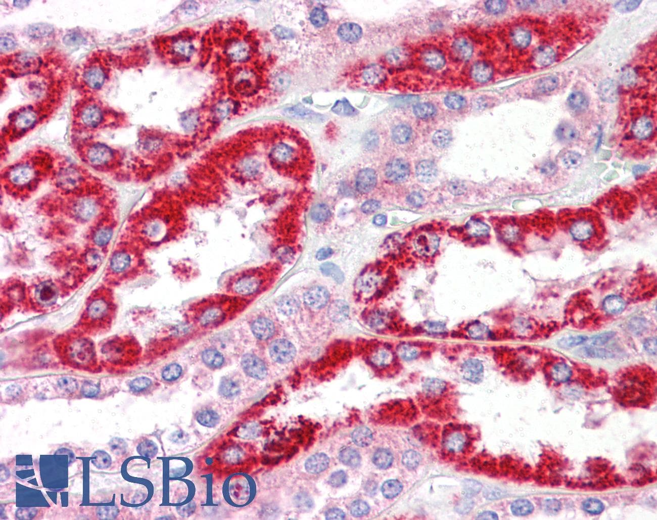 IHC-plus™ Polyclonal Rabbit anti-Human OCIAD2 Antibody (IHC, IF, WB)