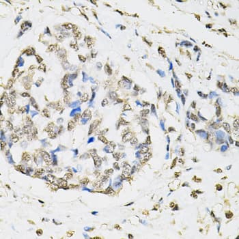 PSMB1 Antibody