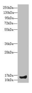 Polyclonal Rabbit anti-Human IFT20 Antibody (IHC, WB)