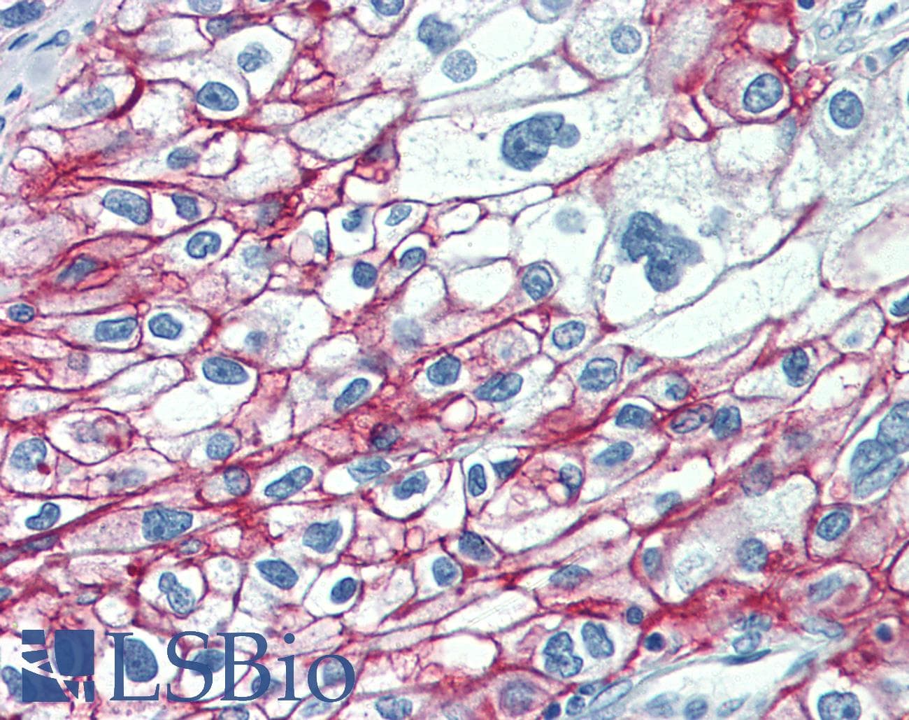 CA9 / Carbonic Anhydrase IX Antibody (C-Terminus, DY488)