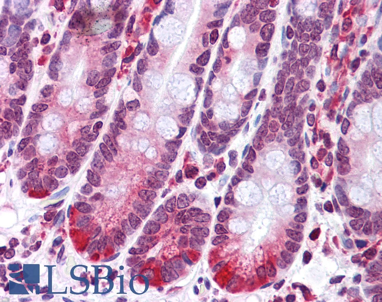 IHC-plus™ SCARA5 Antibody