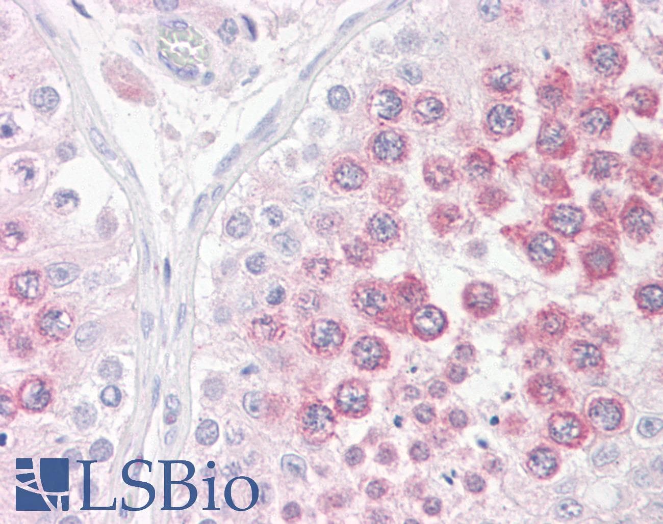 IHC-plus™ BOULE / BOLL Antibody (aa271-283)